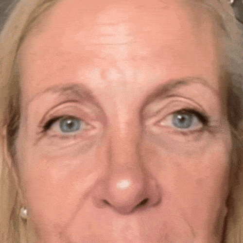 Formula Anti-Rid cu Botox Natural